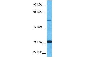 Host:  Rabbit  Target Name:  ZNF35  Sample Type:  Fetal Kidney lysates  Antibody Dilution:  1. (ZNF35 抗体  (N-Term))