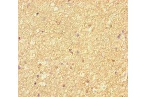 Immunohistochemistry of paraffin-embedded human brain tissue using ABIN7168865 at dilution of 1:100 (Septin 2 抗体  (AA 1-361))