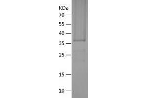 TIA1 Protein (AA 2-285) (His tag)