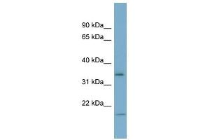 IGFBP2 antibody used at 1 ug/ml to detect target protein. (IGFBP2 抗体  (Middle Region))