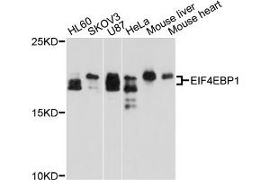 Western blot analysis of extracts of various cell lines, using EIF4EBP1 antibody (ABIN5970590) at 1/1000 dilution. (eIF4EBP1 抗体)