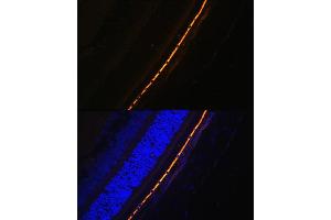 Immunofluorescence analysis of Rat eye cells using RPE65 antibody (ABIN6130679, ABIN6147090, ABIN6147091 and ABIN6225161) at dilution of 1:100. (RPE65 抗体  (AA 274-533))