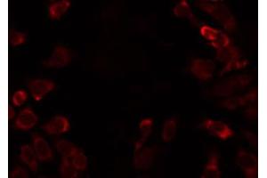 ABIN6274798 staining HT29 by IF/ICC. (ACSS1 抗体  (C-Term))