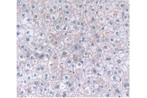Detection of CLEC4C in Human Liver Tissue using Polyclonal Antibody to C-Type Lectin Domain Family 4, Member C (CLEC4C) (CLEC4C 抗体  (AA 5-152))