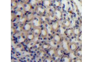 Used in DAB staining on fromalin fixed paraffin-embedded Kidney tissue (MAP4 抗体  (AA 882-1062))