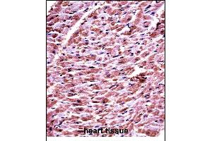 DHRS7C Antibody (Center) ((ABIN657710 and ABIN2846701))immunohistochemistry analysis in formalin fixed and paraffin embedded human heart tissue followed by peroxidase conjugation of the secondary antibody and DAB staining. (DHRS7C 抗体  (AA 116-145))