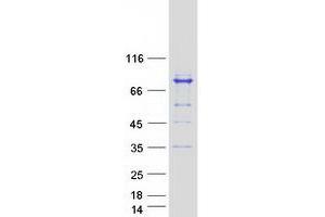 Western Blotting (WB) image for Melanoma Antigen Family D, 2 (MAGED2) (Transcript Variant 3) protein (Myc-DYKDDDDK Tag) (ABIN2725217)
