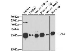 Western blot analysis of extracts of various cell lines using RALB Polyclonal Antibody at dilution of 1:1000. (RALB 抗体)