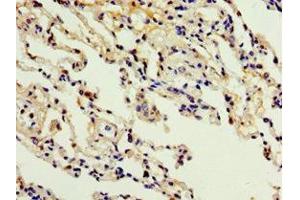 Immunohistochemistry of paraffin-embedded human lung tissue using ABIN7150057 at dilution of 1:100 (ADAM33 抗体  (AA 140-420))
