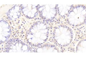 Immunohistochemistry (IHC) image for anti-Sphingosine-1-Phosphate Lyase 1 (SGPL1) (AA 239-493) antibody (ABIN7439186)