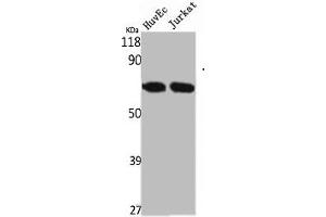 Western Blot analysis of HuvEc Jurkat cells using STK33 Polyclonal Antibody