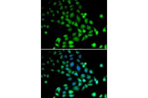 Immunofluorescence analysis of U2OS cells using PARN antibody. (PARN 抗体)