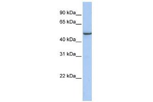 WB Suggested Anti-TMEM184A Antibody Titration: 0. (TMEM184A 抗体  (C-Term))