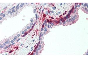 Immunohistochemistry (IHC) image for anti-Anthrax Toxin Receptor 2 (ANTXR2) (AA 34-318) antibody (ABIN7435958)