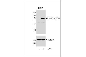 Western blot analysis of lysates from Hela cell line, untreated or treated with UV, 2 hours, using HSPB1 Antibody (R)(upper) or Tubulin (lower). (HSP27 抗体  (pSer78))