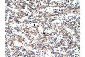 DUT antibody was used for immunohistochemistry at a concentration of 4-8 ug/ml. (Deoxyuridine Triphosphatase (DUT) (C-Term) 抗体)