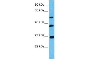 Host:  Mouse  Target Name:  PBX2  Sample Tissue:  Mouse Pancreas  Antibody Dilution:  1ug/ml (PBX2 抗体  (N-Term))