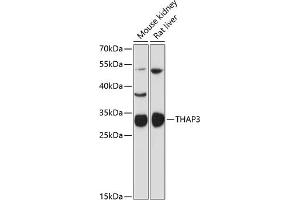 Western blot analysis of extracts of various cell lines, using TH antibody (ABIN6132722, ABIN6149110, ABIN6149112 and ABIN6216701) at 1:3000 dilution. (THAP3 抗体  (AA 1-239))