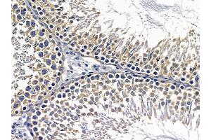 ABIN6257467 and ABIN6274784 at 1/100 staining rat testis tissue by IHC-P.