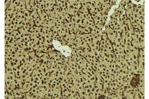 ABIN6276895 at 1/100 staining Mouse liver tissue by IHC-P. (FANCC 抗体  (N-Term))