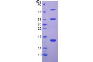 SDS-PAGE analysis of Human Collagen Type X Protein. (COL10 蛋白)