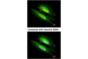 ICC/IF Image Immunofluorescence analysis of methanol-fixed HeLa, using PDE6D, antibody at 1:500 dilution. (PDE6D 抗体  (full length))