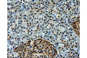 Immunohistochemistry (IHC) image for anti-Induced Myeloid Leukemia Cell Differentiation Protein Mcl-1 (MCL1) antibody (ABIN1499337) (MCL-1 抗体)