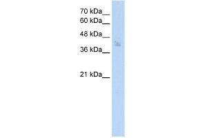 WB Suggested Anti-SPDEF Antibody Titration: 2. (SPDEF/PSE 抗体  (N-Term))