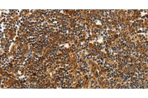Immunohistochemistry of paraffin-embedded Human tonsil tissue using CNNM3 Polyclonal Antibody at dilution 1:40 (Cyclin M3 抗体)