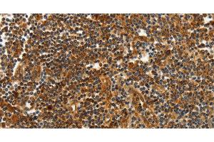 Immunohistochemistry of paraffin-embedded Human tonsil tissue using CNNM3 Polyclonal Antibody at dilution 1:40 (Cyclin M3 抗体)