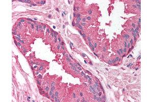 Immunohistochemistry (IHC) image for anti-Proteasome Subunit alpha Type 1 (PSMA1) (AA 170-219) antibody (ABIN6736748)