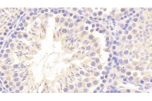 Detection of CRAT in Mouse Testis Tissue using Polyclonal Antibody to Carnitine Acetyltransferase (CRAT) (CRAT 抗体  (AA 1-430))