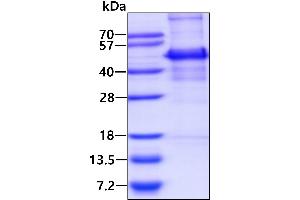 SDS-PAGE (SDS) image for Sequestosome 1 (SQSTM1) (AA 1-356) protein (His tag) (ABIN666979)
