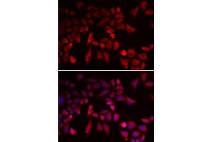 Immunofluorescence analysis of MCF-7 cells using PYGL antibody. (PYGL 抗体  (AA 1-280))