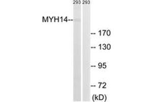 Western blot analysis of extracts from 293 cells, using MYH14 Antibody. (Myosin 抗体  (AA 1051-1100))
