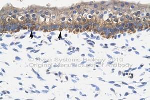 Image no. 1 for anti-SRY (Sex Determining Region Y)-Box 10 (SOX10) (AA 191-240) antibody (ABIN6746058) (SOX10 抗体  (AA 191-240))