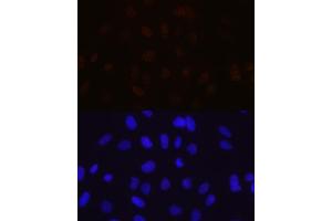 Immunofluorescence analysis of U-2 OS cells using MBNL1 Rabbit mAb (ABIN7268704) at dilution of 1:100 (40x lens). (MBNL1 抗体)