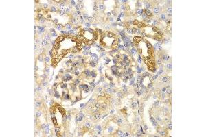 Immunohistochemistry of paraffin-embedded rat kidney using PYCARD antibody at dilution of 1:100 (400x lens). (STS 抗体)