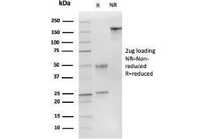 SDS-PAGE Analysis Purified p27 MAb (DCS-72. (CDKN1B 抗体)