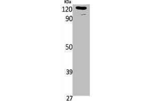 Western Blot analysis of K562, cells using Phospho-Ob-R (Y1141) Polyclonal Antibody (Leptin Receptor 抗体  (pTyr1141))