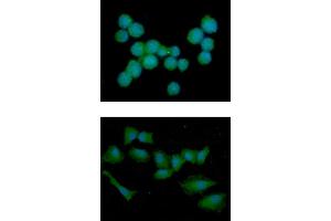ICC/IF analysis of NBL1 in Jurkat cells line, stained with DAPI (Blue) for nucleus staining and monoclonal anti-human NBL1 antibody (1:100) with goat anti-mouse IgG-Alexa fluor 488 conjugate (Green). (NBL1 抗体)