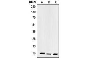 Western blot analysis of RPL28 expression in HeLa (A), MCF7 (B), HEK293 (C) whole cell lysates.