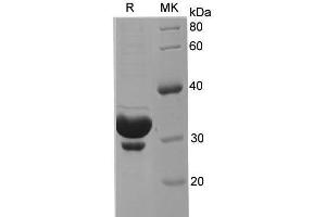 Western Blotting (WB) image for Keratin 18 (KRT18) protein (His tag) (ABIN7320876) (Cytokeratin 18 Protein (His tag))
