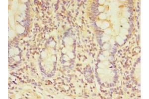 Immunohistochemistry of paraffin-embedded human small intestine tissue using ABIN7172078 at dilution of 1:100 (TARS2 抗体  (AA 369-718))