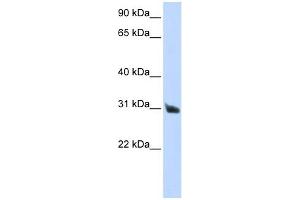 RNASE9 antibody used at 1 ug/ml to detect target protein. (RNASE9 抗体)