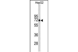 Western blot analysis of FBXO3 Antibody in HepG2 cell line lysates (35ug/lane) (F-Box Protein 3 抗体  (C-Term))