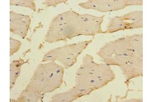 Immunohistochemistry of paraffin-embedded human skeletal muscle tissue using ABIN7150707 at dilution of 1:100 (MAP2K3 抗体  (AA 1-347))
