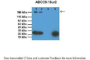 Lanes:   1: 10ug SUR1 KO mouse ventricle lysate, 2: 10ug WT mouse ventricle lysate, 3: 0. (ABCC9 抗体  (Middle Region))