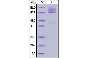 SDS-PAGE (SDS) image for Glypican 3 (GPC3) (AA 25-559) (Active) protein (His tag) (ABIN5526592)
