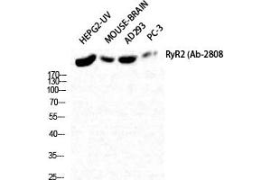 anti-Ryanodine Receptor 2 (Cardiac) (RYR2) antibody